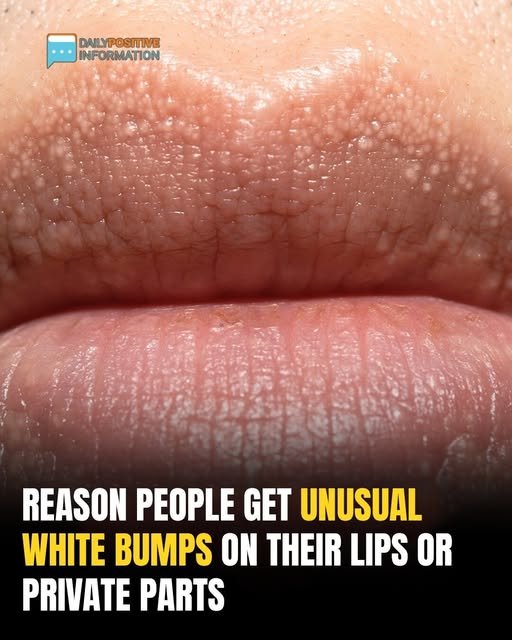 The Cause Of The Odd White Pimples On Your Your Body